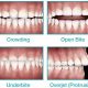 ortodontik problemler