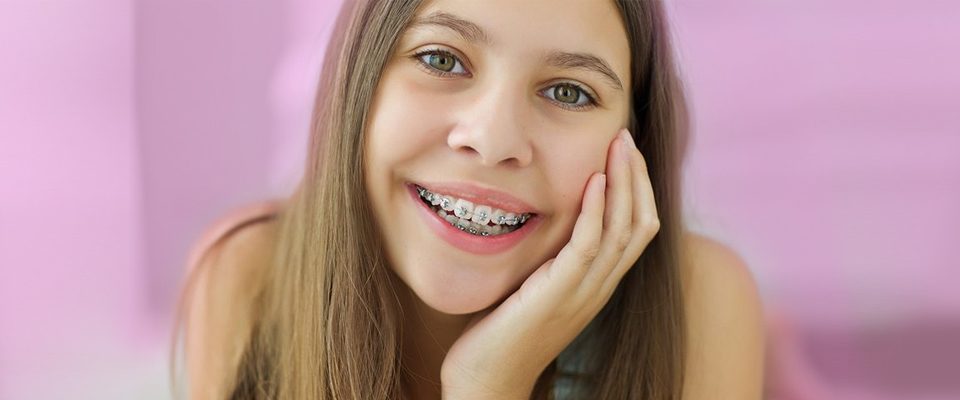 ortodonti tedavisi aşamaları