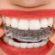 Şeffaf plaklarla ortodontik tedavi